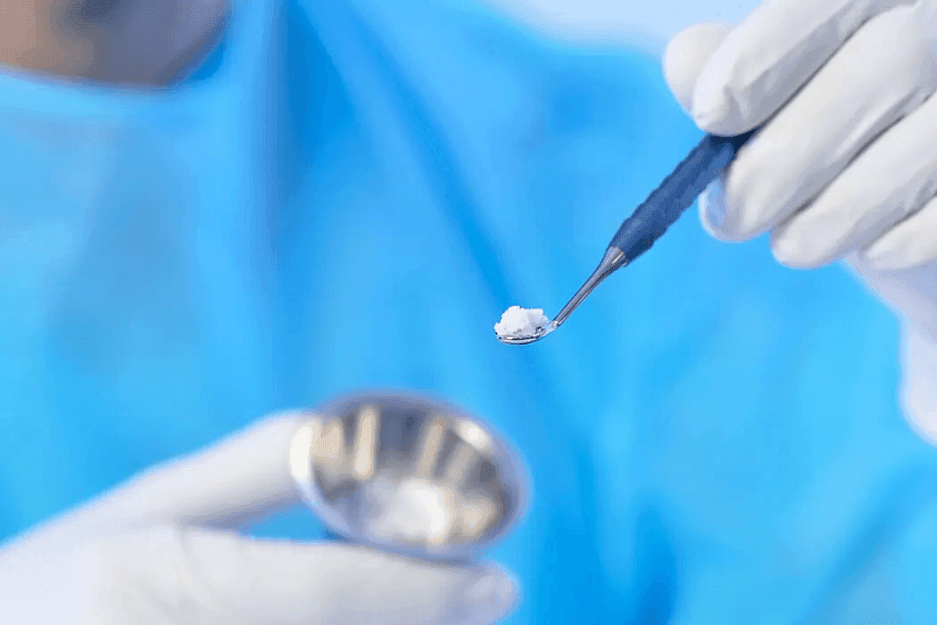 Bone grafting and sinus lift